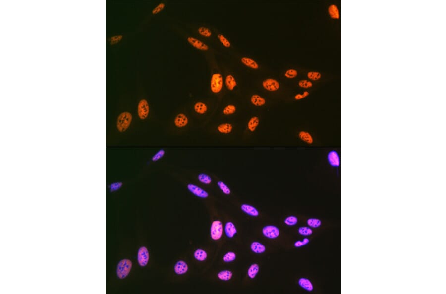 Immunofluorescence - Anti-PRP19 Antibody [ARC1685] (A305915) - Antibodies.com