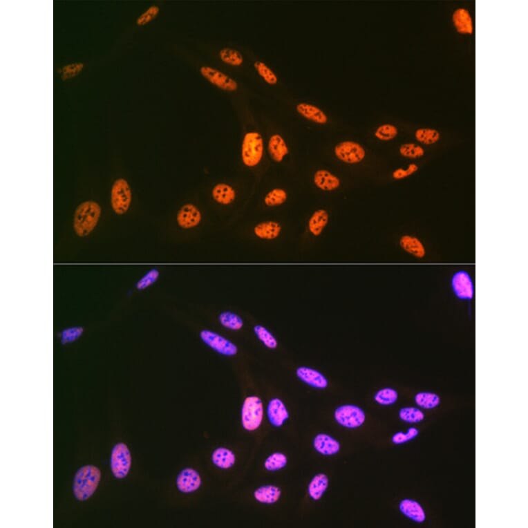 Immunofluorescence - Anti-PRP19 Antibody [ARC1685] (A305915) - Antibodies.com