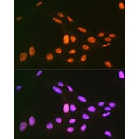 Immunofluorescence - Anti-PRP19 Antibody [ARC1685] (A305915) - Antibodies.com