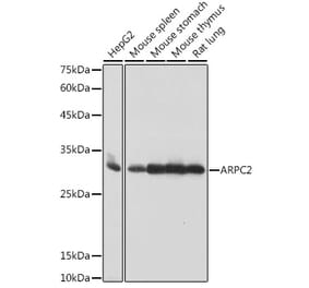 Western Blot - Anti-ARPC2 Antibody [ARC2558] (A305917) - Antibodies.com