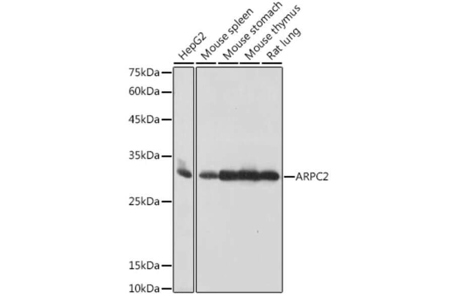 Western Blot - Anti-ARPC2 Antibody [ARC2558] (A305917) - Antibodies.com