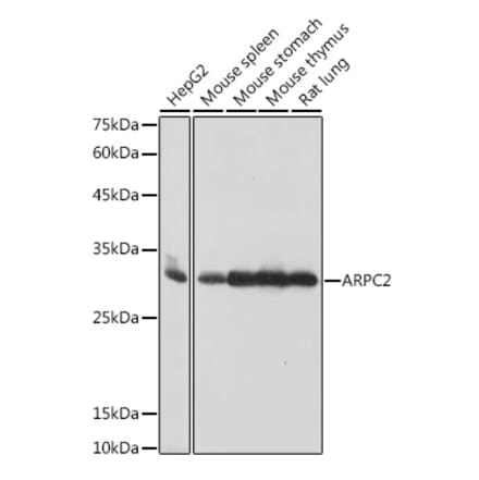 Western Blot - Anti-ARPC2 Antibody [ARC2558] (A305917) - Antibodies.com