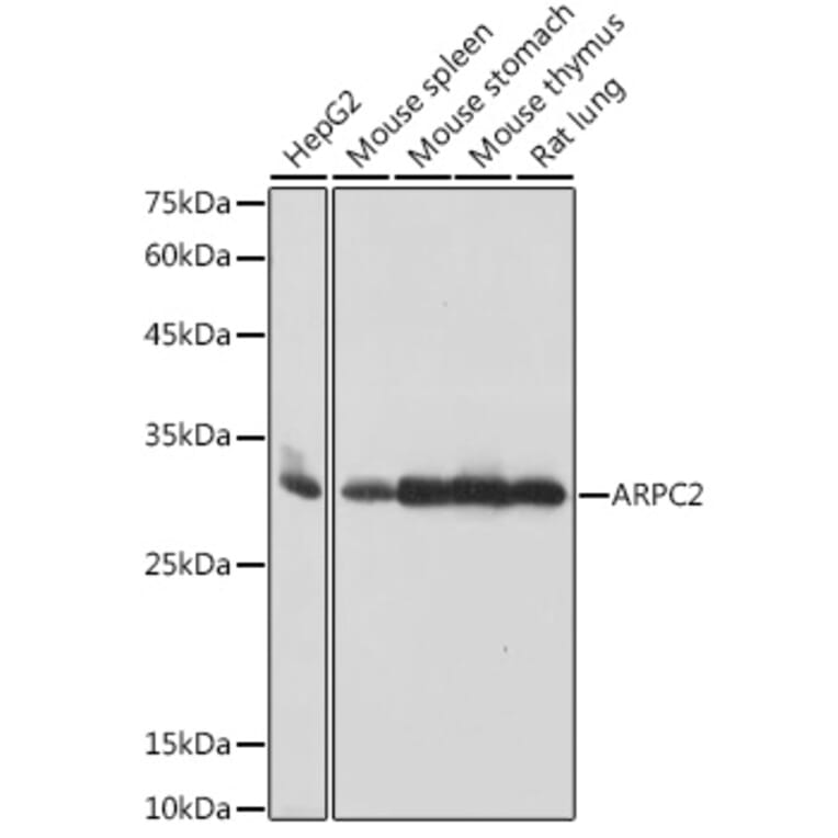 Western Blot - Anti-ARPC2 Antibody [ARC2558] (A305917) - Antibodies.com