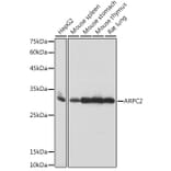 Western Blot - Anti-ARPC2 Antibody [ARC2558] (A305917) - Antibodies.com