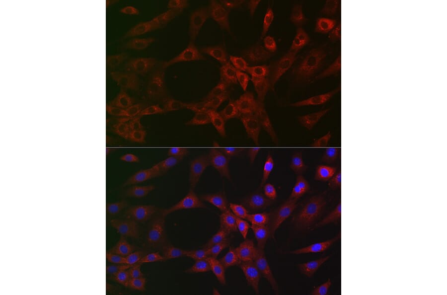 Immunofluorescence - Anti-ARPC2 Antibody [ARC2558] (A305917) - Antibodies.com