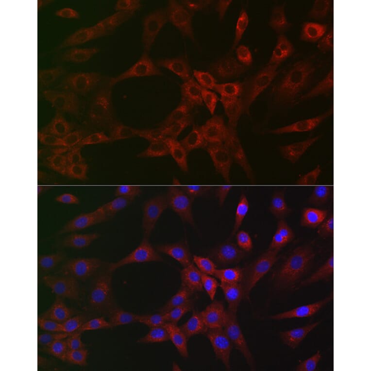 Immunofluorescence - Anti-ARPC2 Antibody [ARC2558] (A305917) - Antibodies.com