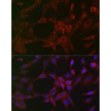 Immunofluorescence - Anti-ARPC2 Antibody [ARC2558] (A305917) - Antibodies.com