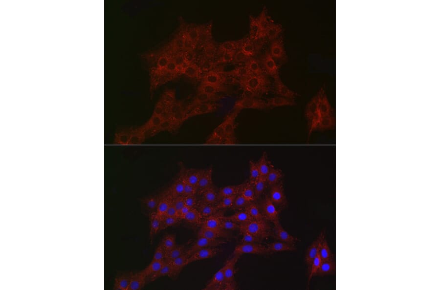 Immunofluorescence - Anti-ARPC2 Antibody [ARC2558] (A305917) - Antibodies.com