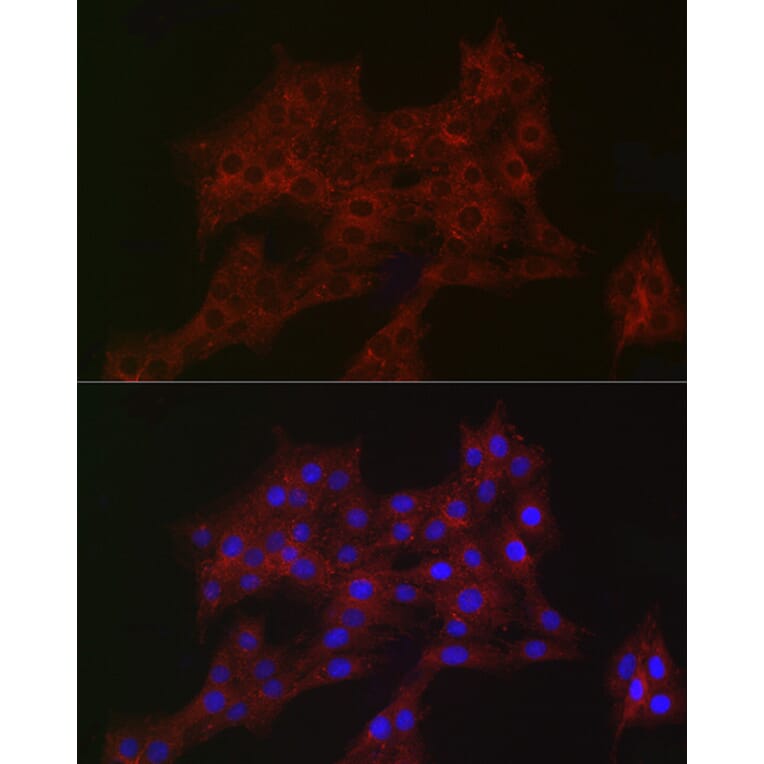 Immunofluorescence - Anti-ARPC2 Antibody [ARC2558] (A305917) - Antibodies.com