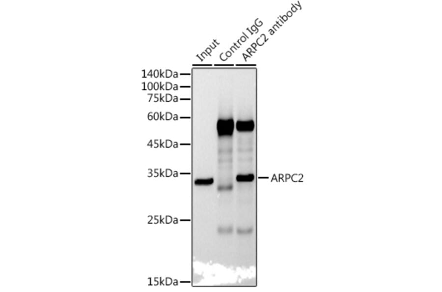 Western Blot - Anti-ARPC2 Antibody [ARC2558] (A305917) - Antibodies.com