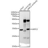 Western Blot - Anti-ARPC2 Antibody [ARC2558] (A305917) - Antibodies.com