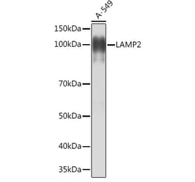 Western Blot - Anti-LAMP2 Antibody [ARC0274] (A305918) - Antibodies.com