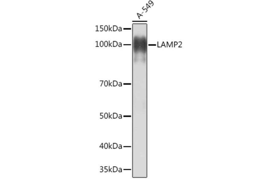 Western Blot - Anti-LAMP2 Antibody [ARC0274] (A305918) - Antibodies.com