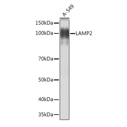 Western Blot - Anti-LAMP2 Antibody [ARC0274] (A305918) - Antibodies.com