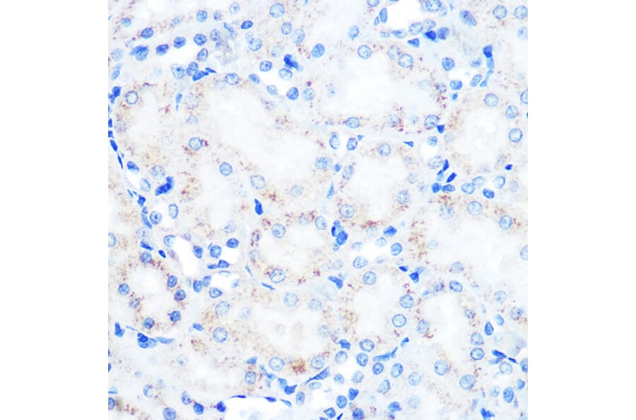 Immunohistochemistry - Anti-LAMP2 Antibody [ARC0274] (A305918) - Antibodies.com