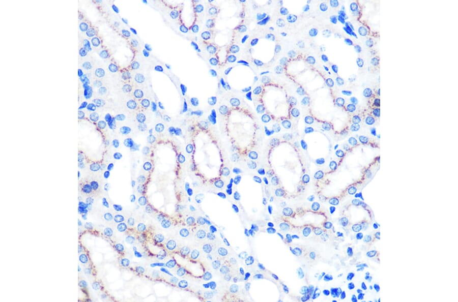 Immunohistochemistry - Anti-LAMP2 Antibody [ARC0274] (A305918) - Antibodies.com