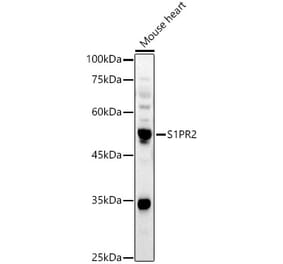 Western Blot - Anti-S1PR2 Antibody (A305919) - Antibodies.com