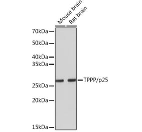 Western Blot - Anti-TPPP Antibody [ARC1129] (A305920) - Antibodies.com