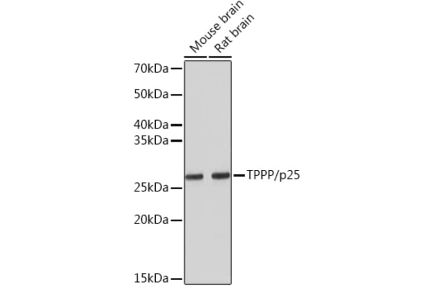 Western Blot - Anti-TPPP Antibody [ARC1129] (A305920) - Antibodies.com