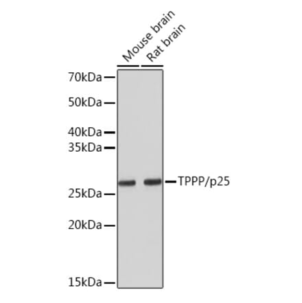 Western Blot - Anti-TPPP Antibody [ARC1129] (A305920) - Antibodies.com