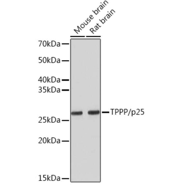 Western Blot - Anti-TPPP Antibody [ARC1129] (A305920) - Antibodies.com