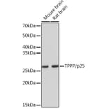 Western Blot - Anti-TPPP Antibody [ARC1129] (A305920) - Antibodies.com