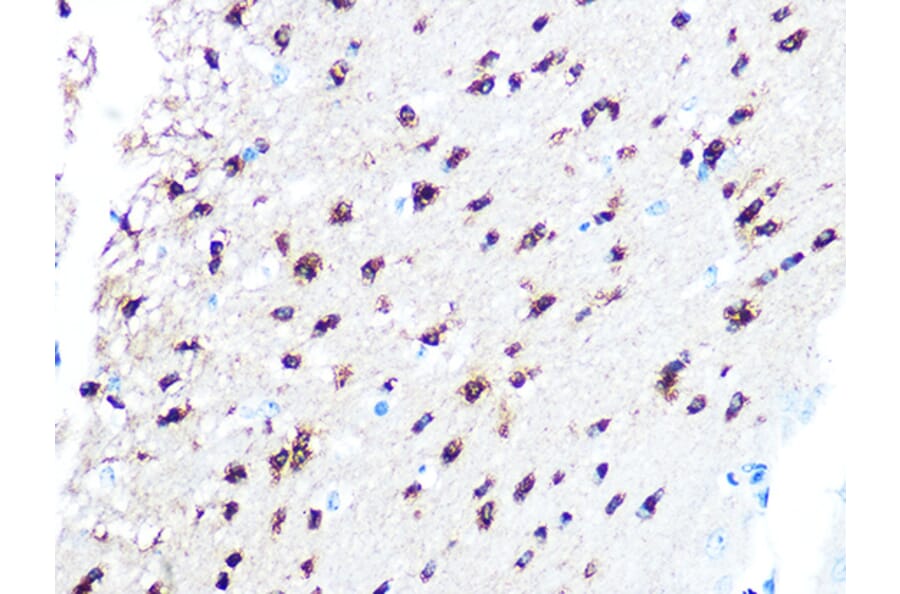Immunohistochemistry - Anti-TPPP Antibody [ARC1129] (A305920) - Antibodies.com