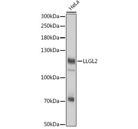 Western Blot - Anti-LLGL2 Antibody (A305921) - Antibodies.com