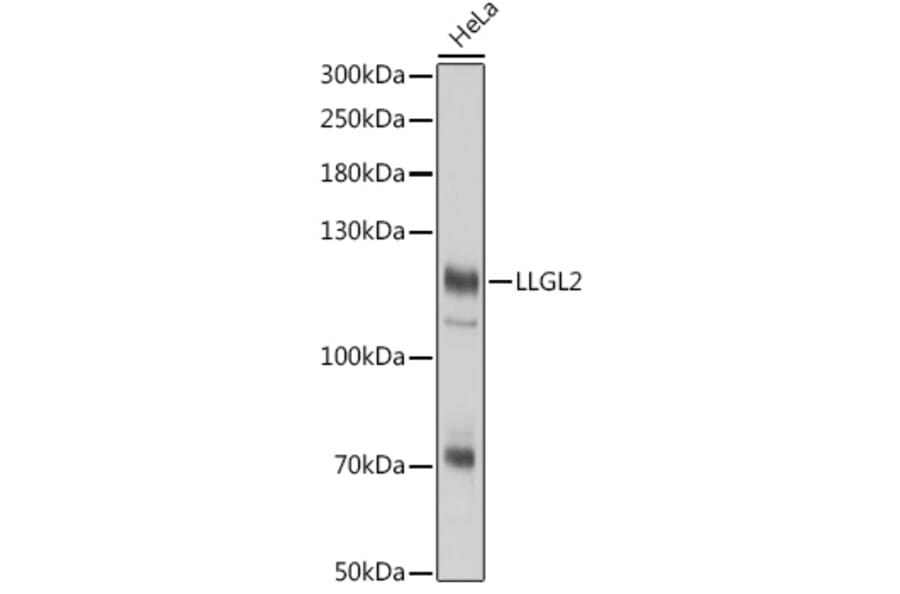 Western Blot - Anti-LLGL2 Antibody (A305921) - Antibodies.com