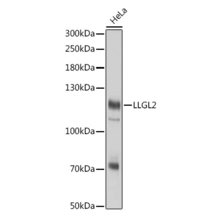Western Blot - Anti-LLGL2 Antibody (A305921) - Antibodies.com