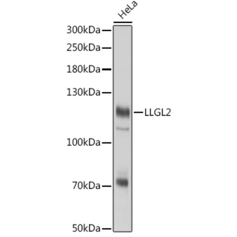 Western Blot - Anti-LLGL2 Antibody (A305921) - Antibodies.com