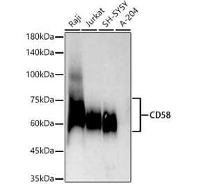 Western Blot - Anti-CD58 Antibody [ARC54834] (A305922) - Antibodies.com