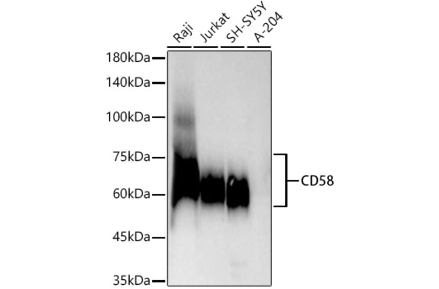 Western Blot - Anti-CD58 Antibody [ARC54834] (A305922) - Antibodies.com