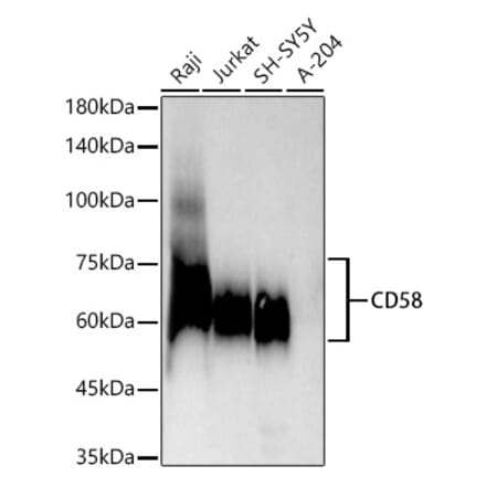 Western Blot - Anti-CD58 Antibody [ARC54834] (A305922) - Antibodies.com