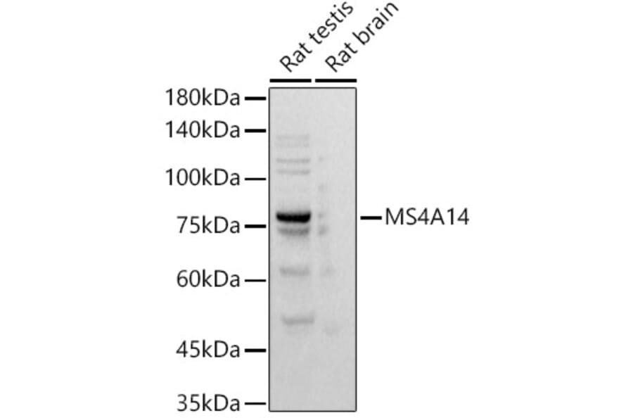 Western Blot - Anti-MS4A14 Antibody [ARC2954] (A305923) - Antibodies.com