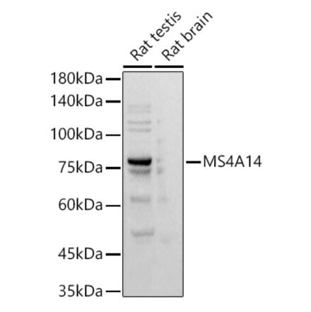 Western Blot - Anti-MS4A14 Antibody [ARC2954] (A305923) - Antibodies.com
