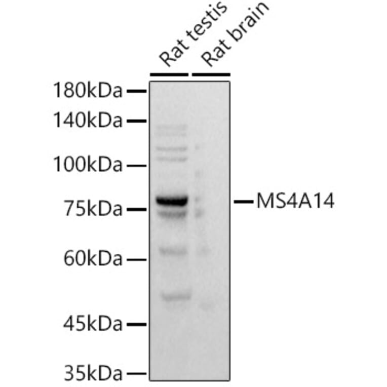 Western Blot - Anti-MS4A14 Antibody [ARC2954] (A305923) - Antibodies.com