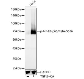 Western Blot - Anti-NF-kB p65 (phospho Ser536) Antibody [ARC55585] (A305925) - Antibodies.com
