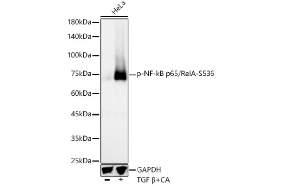 Western Blot - Anti-NF-kB p65 (phospho Ser536) Antibody [ARC55585] (A305925) - Antibodies.com