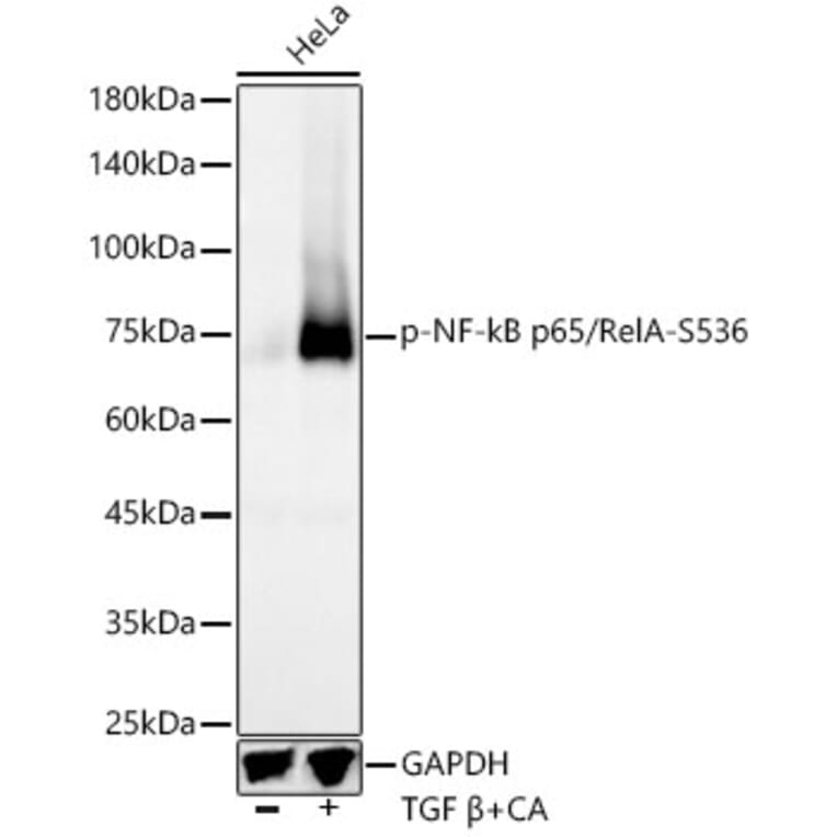 Western Blot - Anti-NF-kB p65 (phospho Ser536) Antibody [ARC55585] (A305925) - Antibodies.com