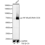Western Blot - Anti-NF-kB p65 (phospho Ser536) Antibody [ARC55585] (A305925) - Antibodies.com