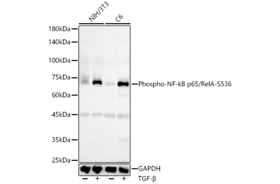 Western Blot - Anti-NF-kB p65 (phospho Ser536) Antibody [ARC55585] (A305925) - Antibodies.com
