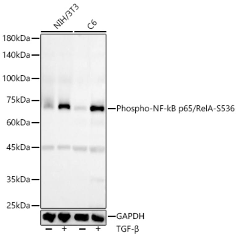 Western Blot - Anti-NF-kB p65 (phospho Ser536) Antibody [ARC55585] (A305925) - Antibodies.com