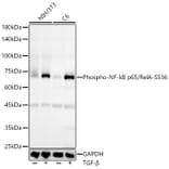 Western Blot - Anti-NF-kB p65 (phospho Ser536) Antibody [ARC55585] (A305925) - Antibodies.com