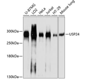 Western Blot - Anti-USP24 Antibody (A305927) - Antibodies.com