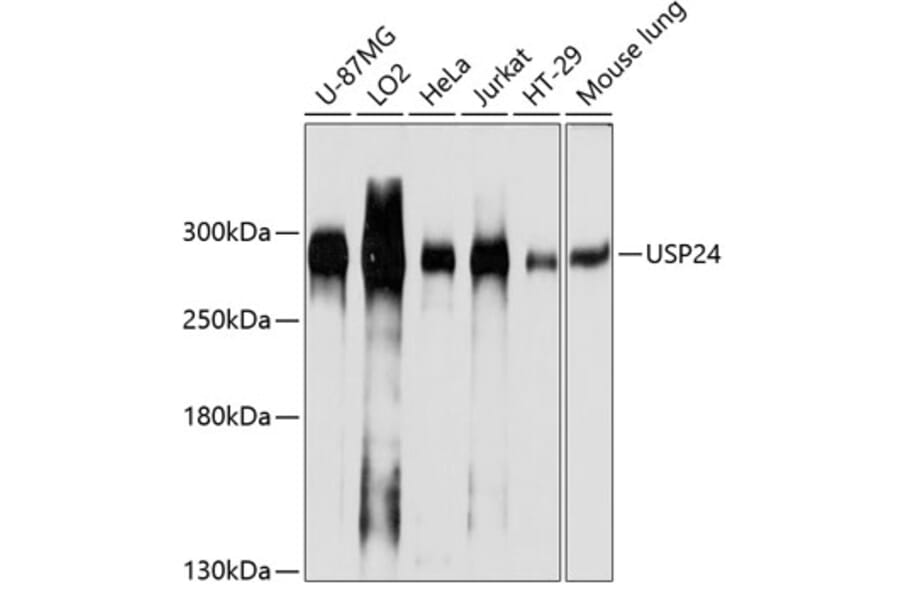 Western Blot - Anti-USP24 Antibody (A305927) - Antibodies.com