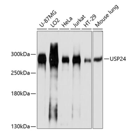 Western Blot - Anti-USP24 Antibody (A305927) - Antibodies.com