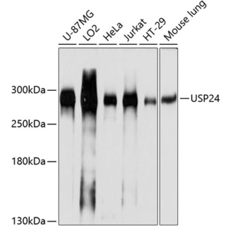 Western Blot - Anti-USP24 Antibody (A305927) - Antibodies.com