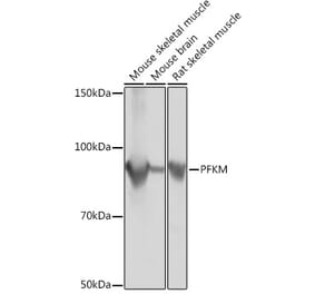 Western Blot - Anti-PFKM Antibody [ARC0819] (A305930) - Antibodies.com