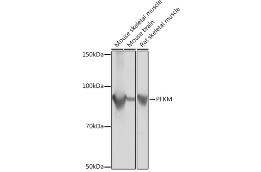 Western Blot - Anti-PFKM Antibody [ARC0819] (A305930) - Antibodies.com